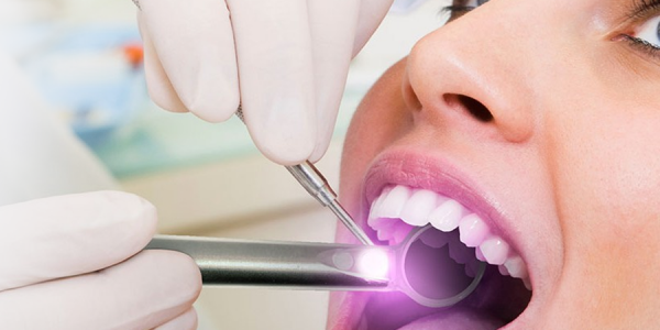 dental implants the woodlands